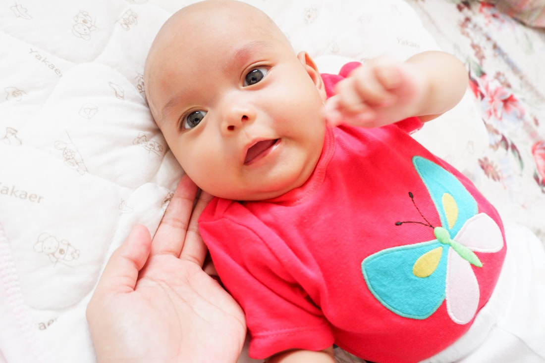 Tips Mengobati Belekan Pada Mata Bayi
